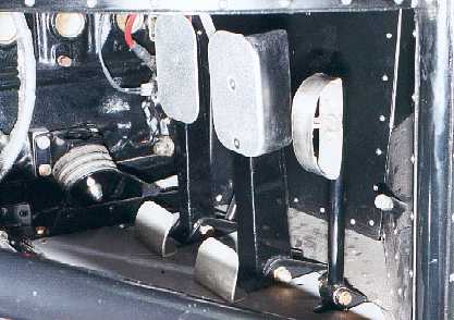 The Pedals.