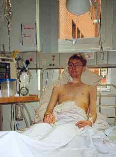 24 hours post colon removal